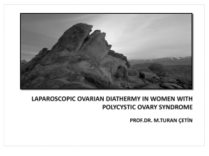 laparoscopıc ovarıan dıathermy ın women wıth polycystıc ovary